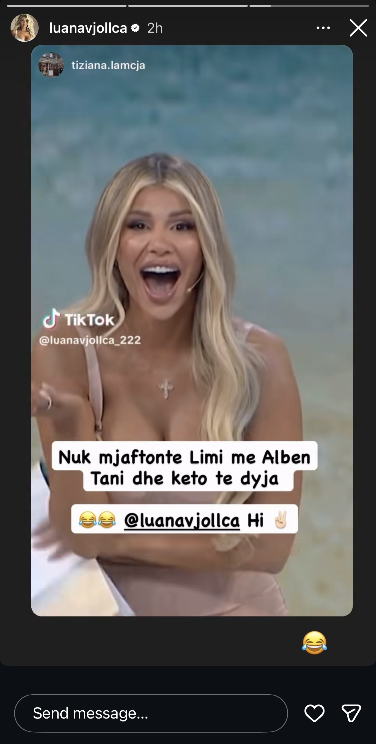 Thanë se është e bërë me botoks, reagon Luana Vjollca pas përfshirjes në debatin Ina-Brikena