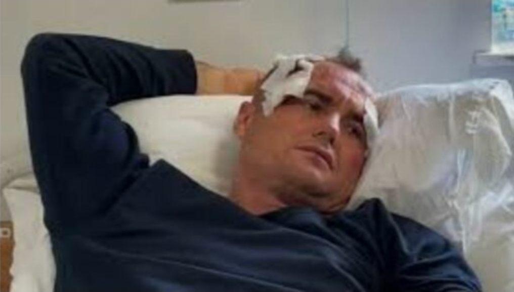 I riu rrahet nga polici në Fier  I komentova motrës së tij në Facebook je bërë shumë e bukur