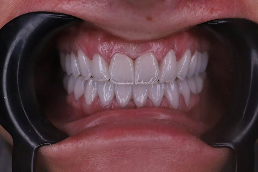 7 këshilla për të pasur dhëmbë të bardhë dhe të shëndetshëm